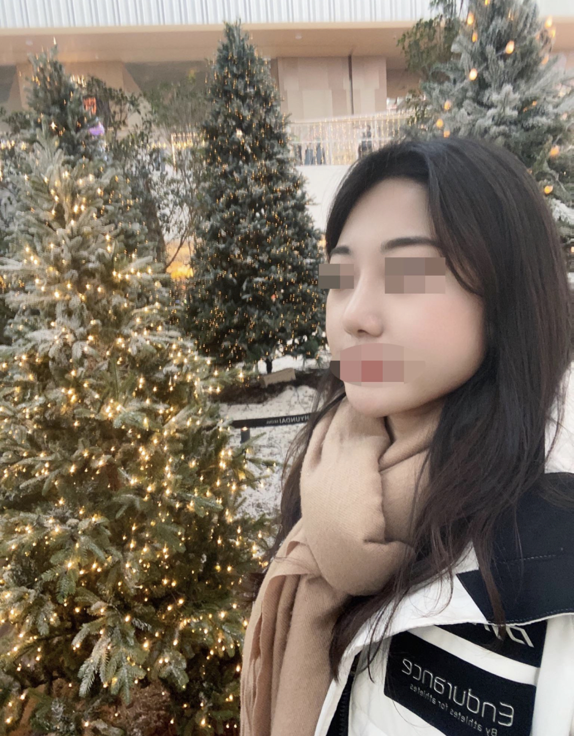 수술후기이미지