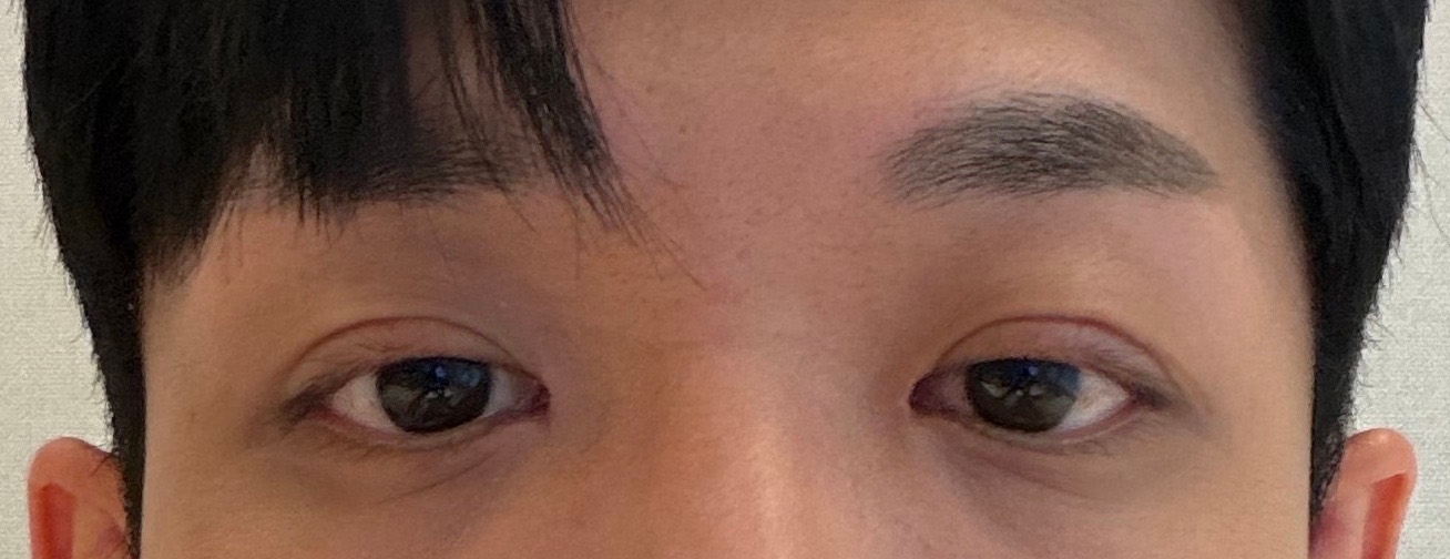 수술후기이미지