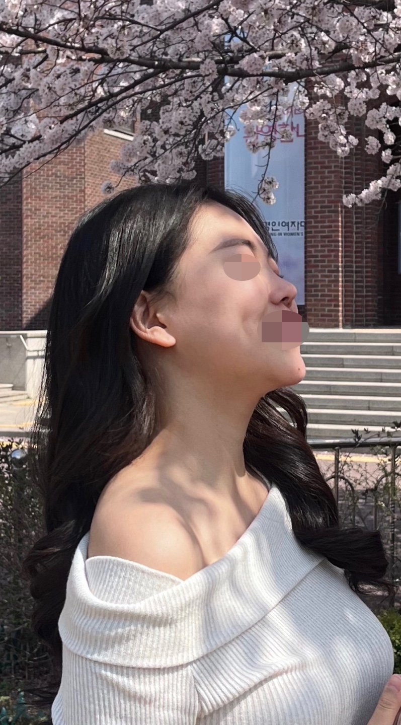 수술후기이미지