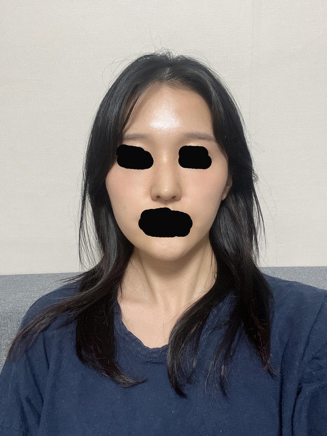 수술후기이미지