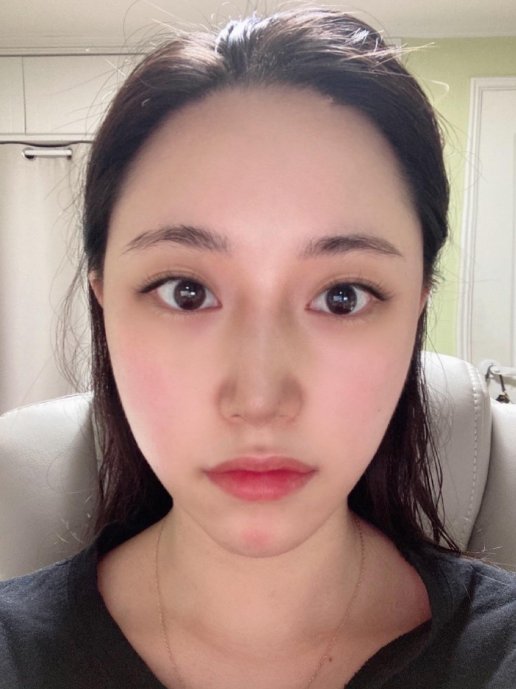 수술후기이미지