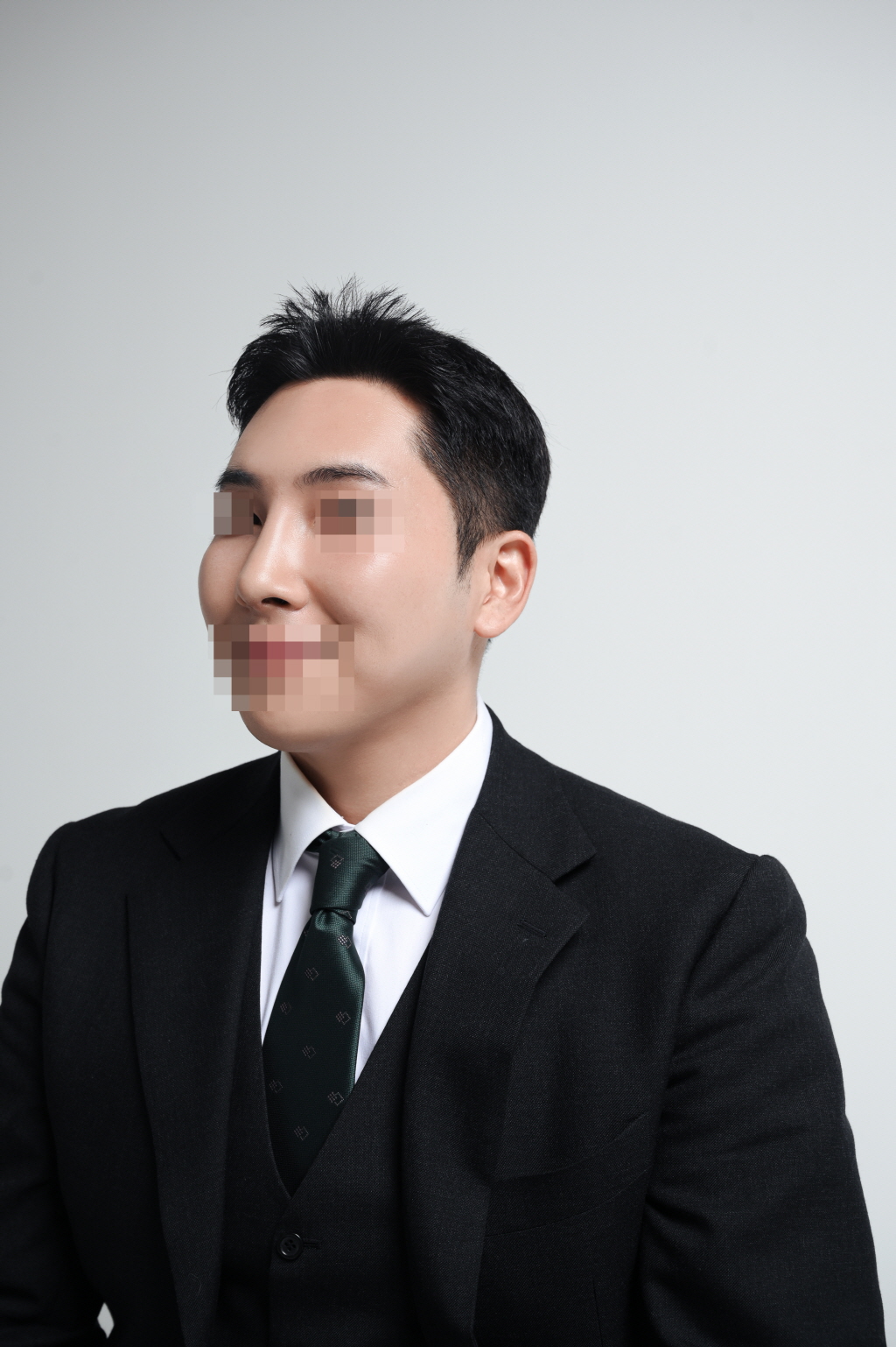 수술후기이미지