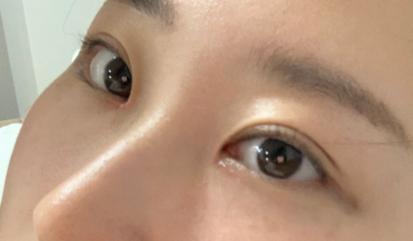 수술후기이미지