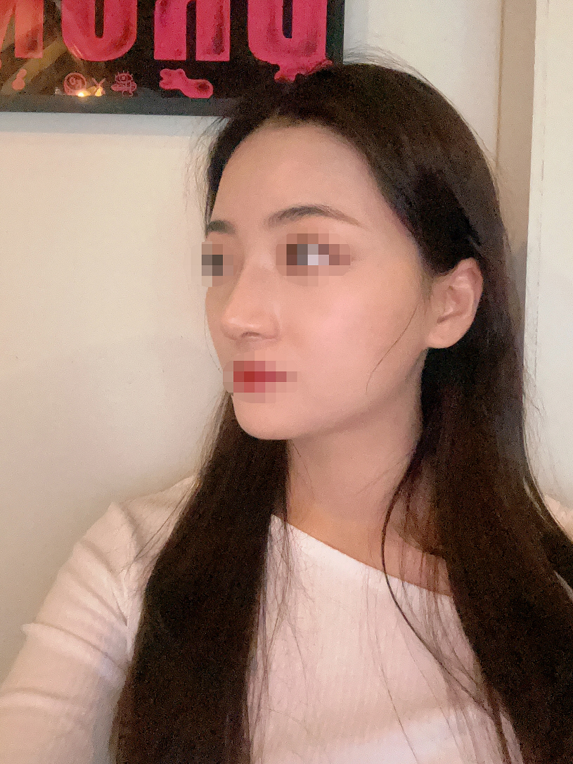 수술후기이미지