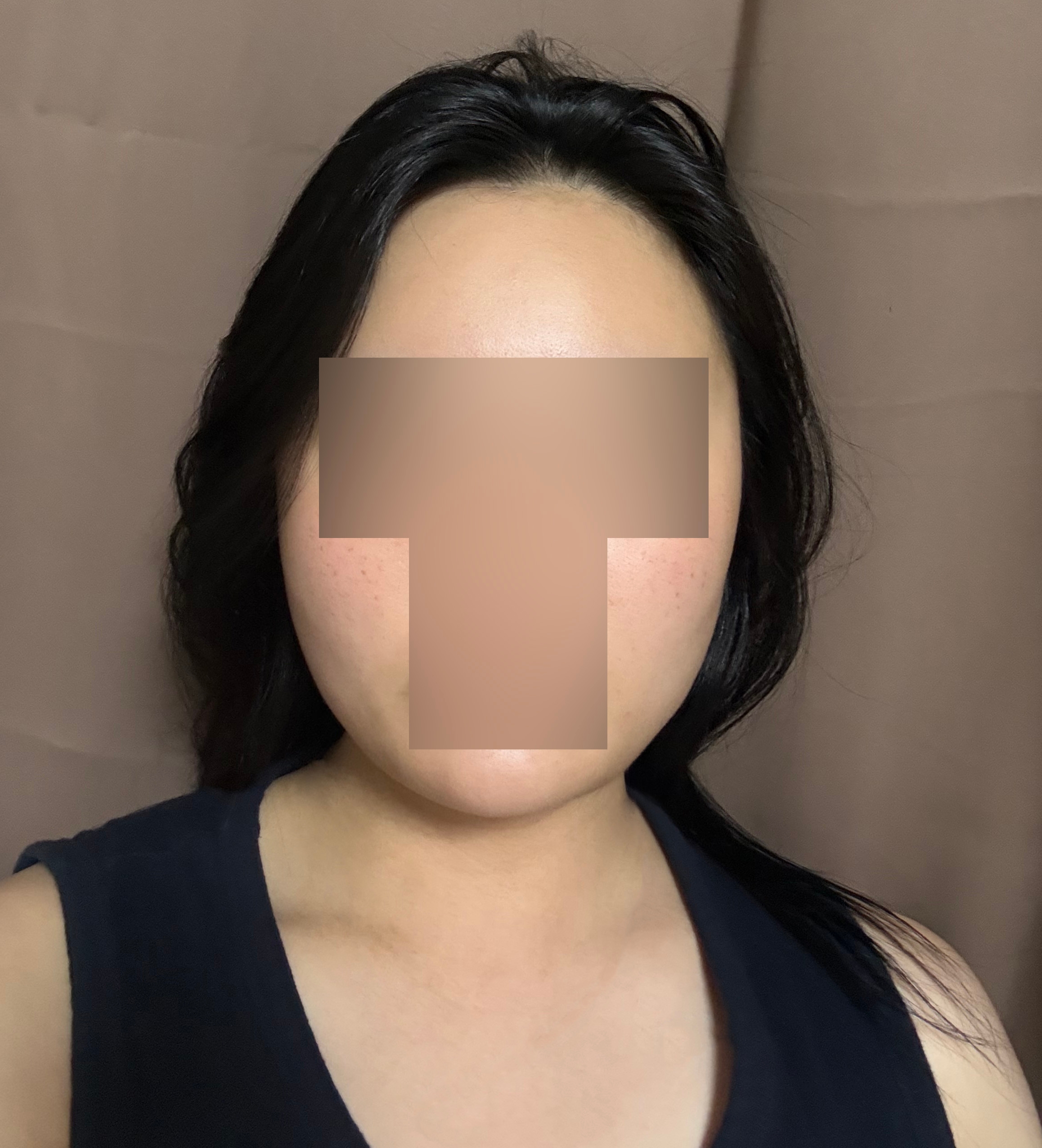수술후기이미지