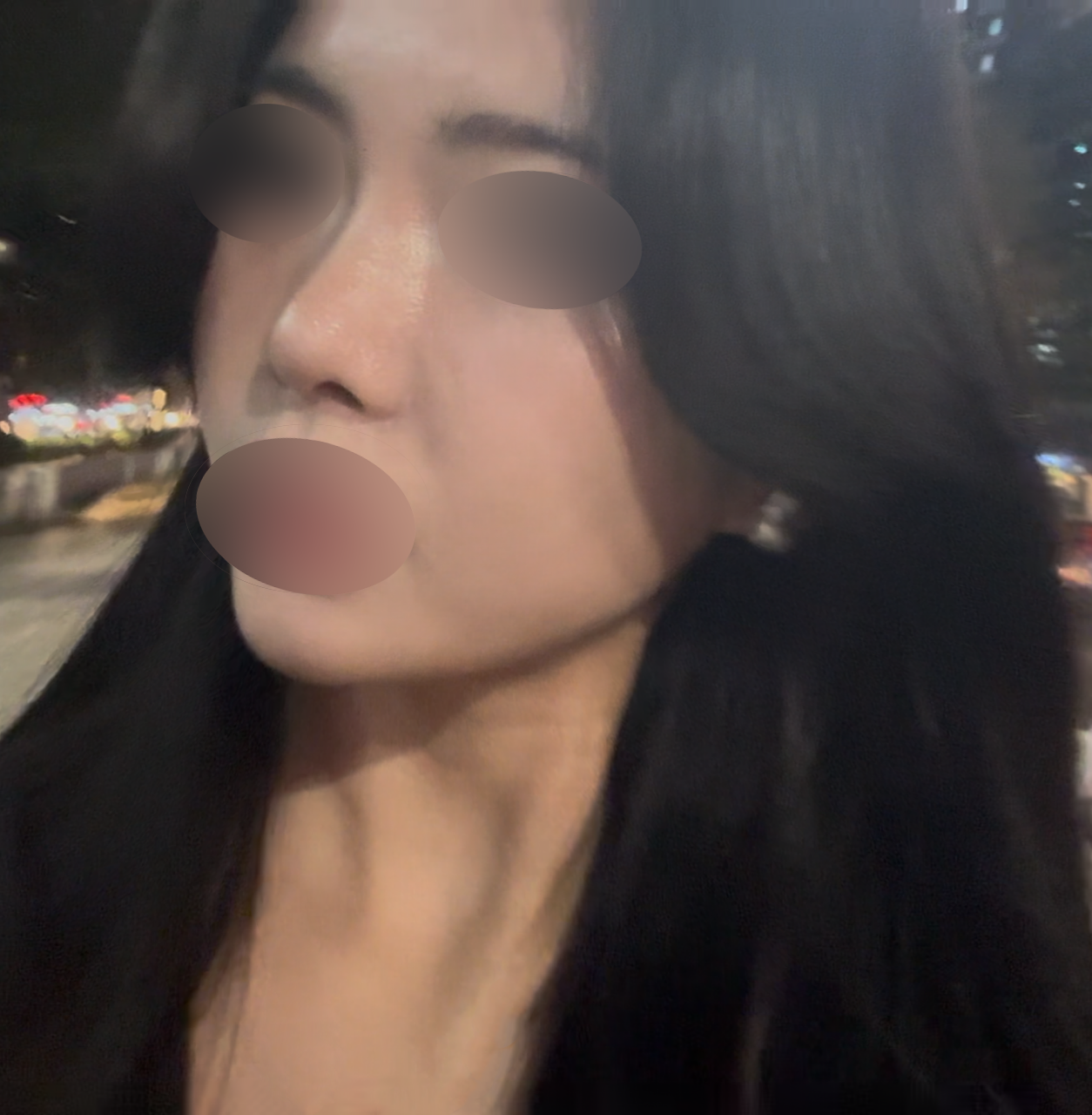 수술후기이미지