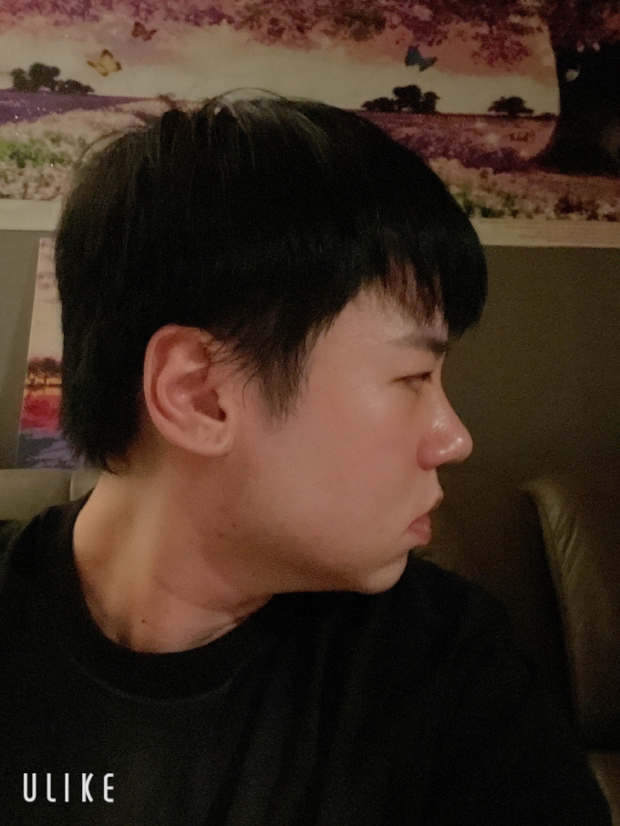 수술후기이미지