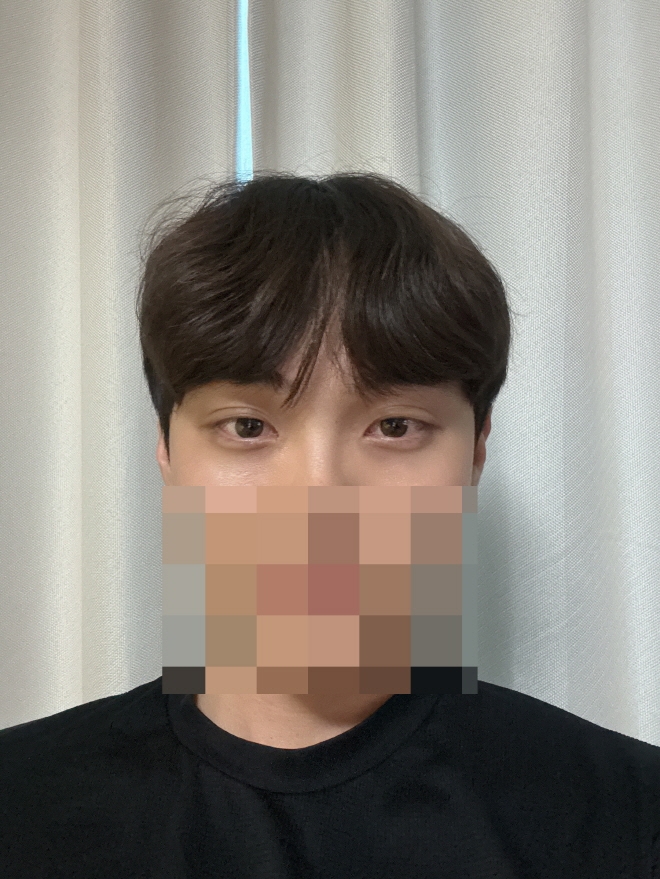 수술후기이미지