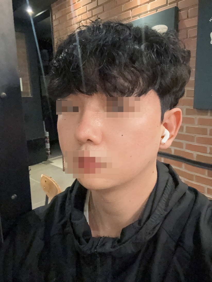 수술후기이미지