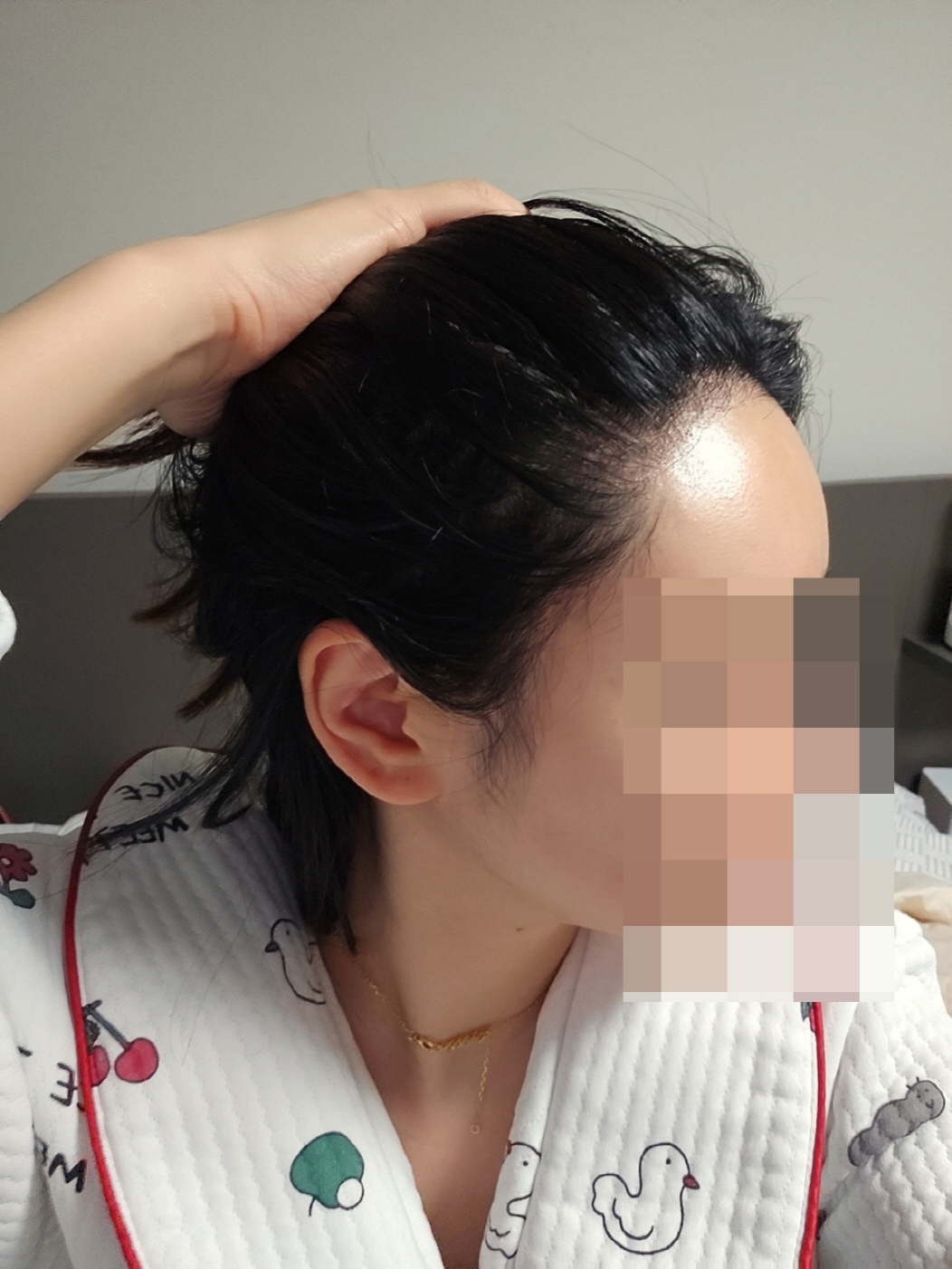 수술후기이미지