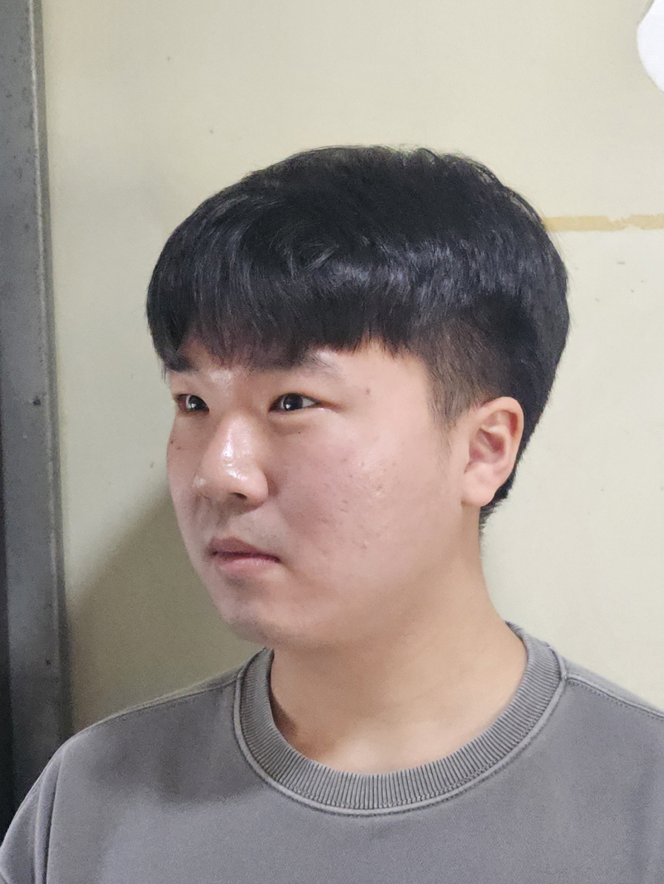 수술후기이미지