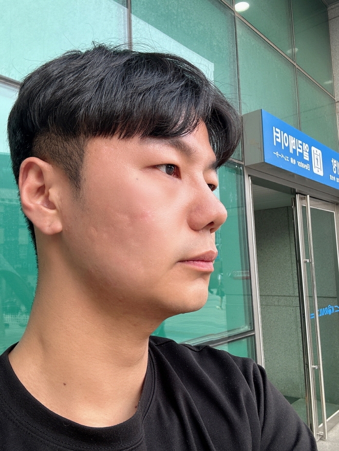 수술후기이미지