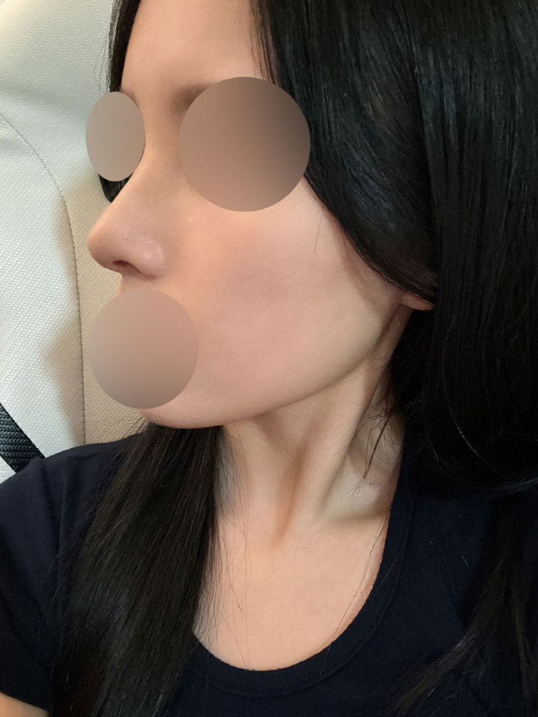 수술후기이미지