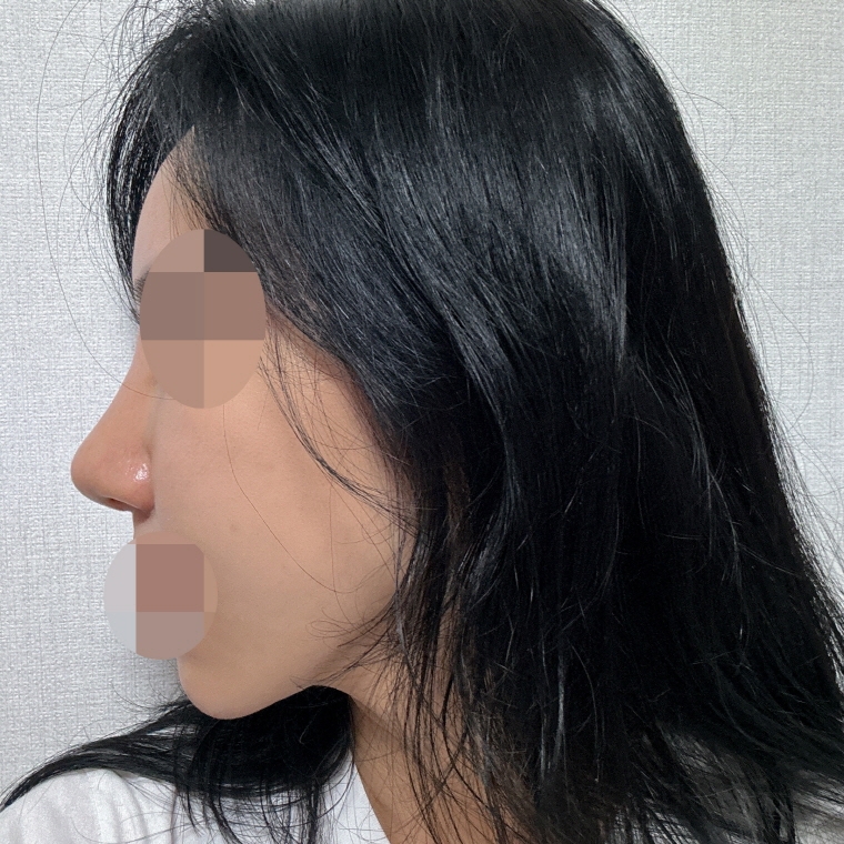 수술후기이미지