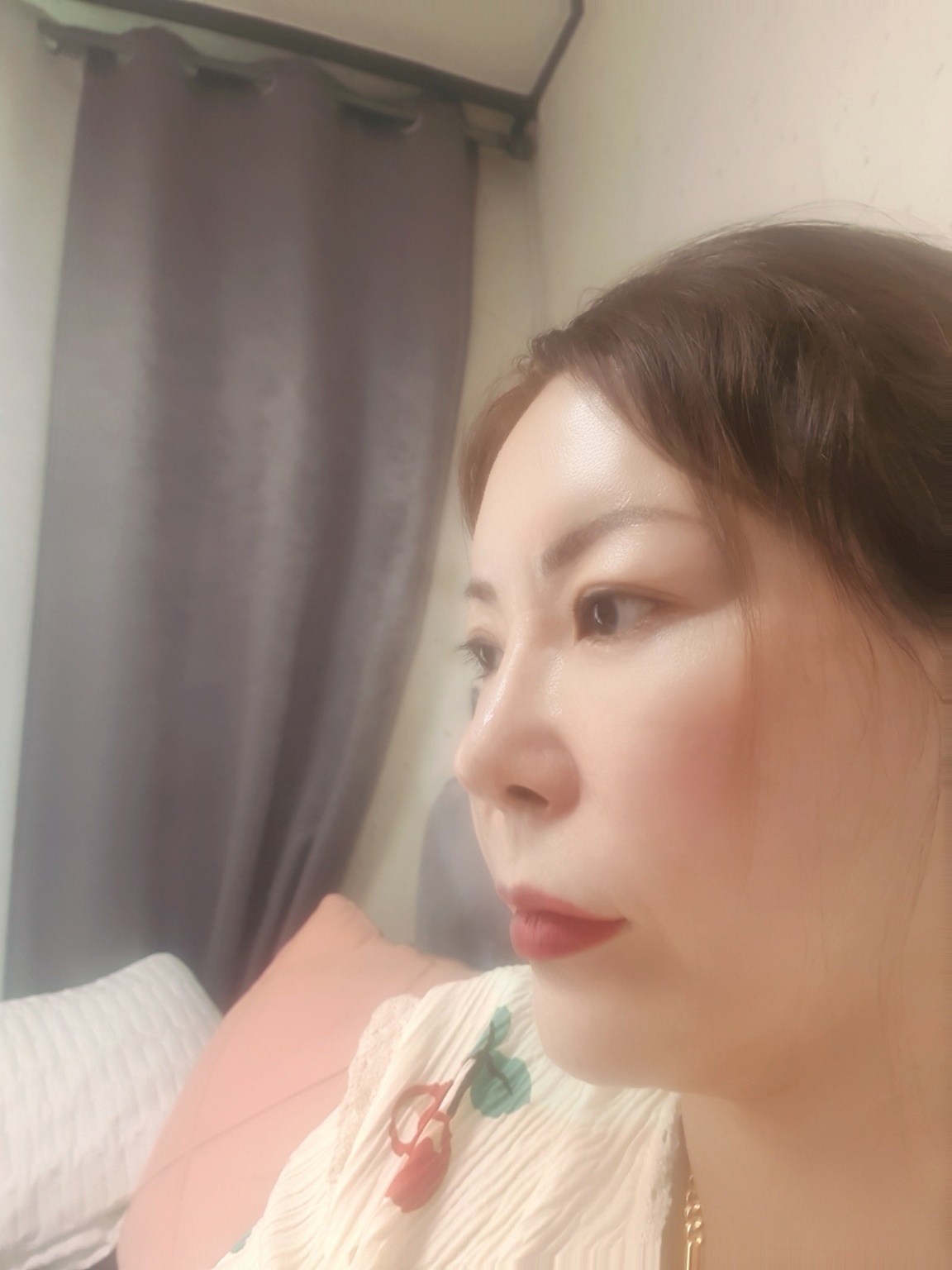 수술후기이미지