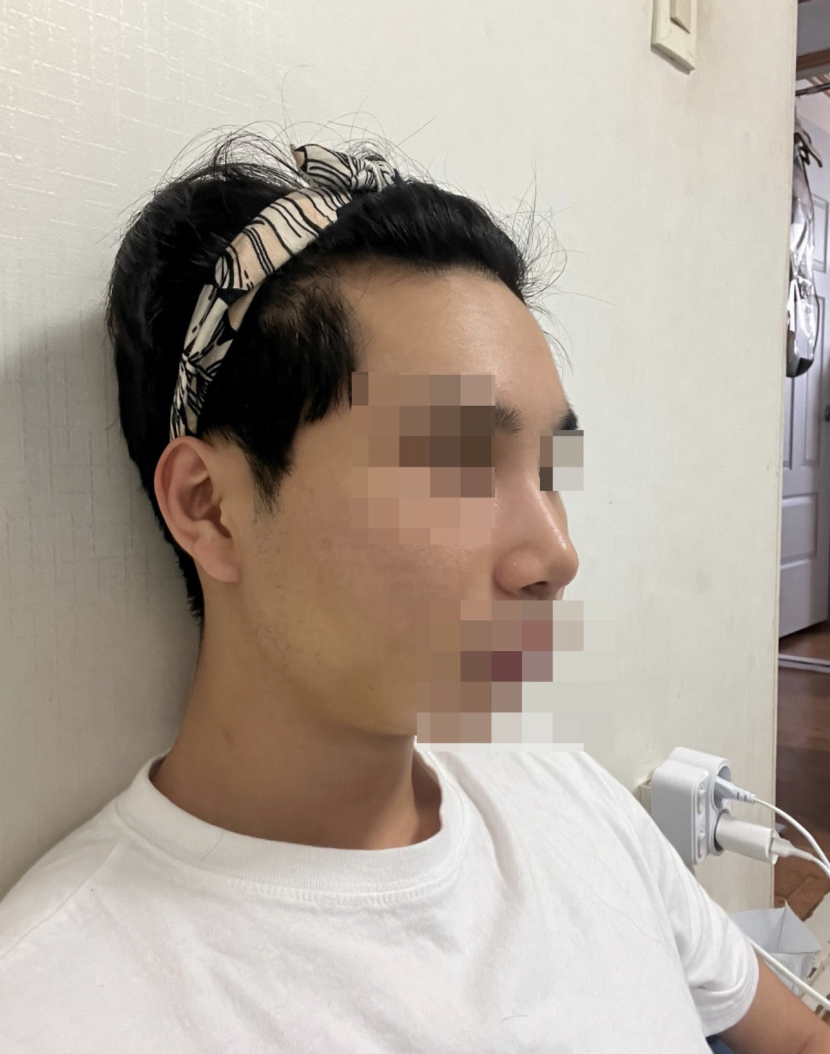 수술후기이미지