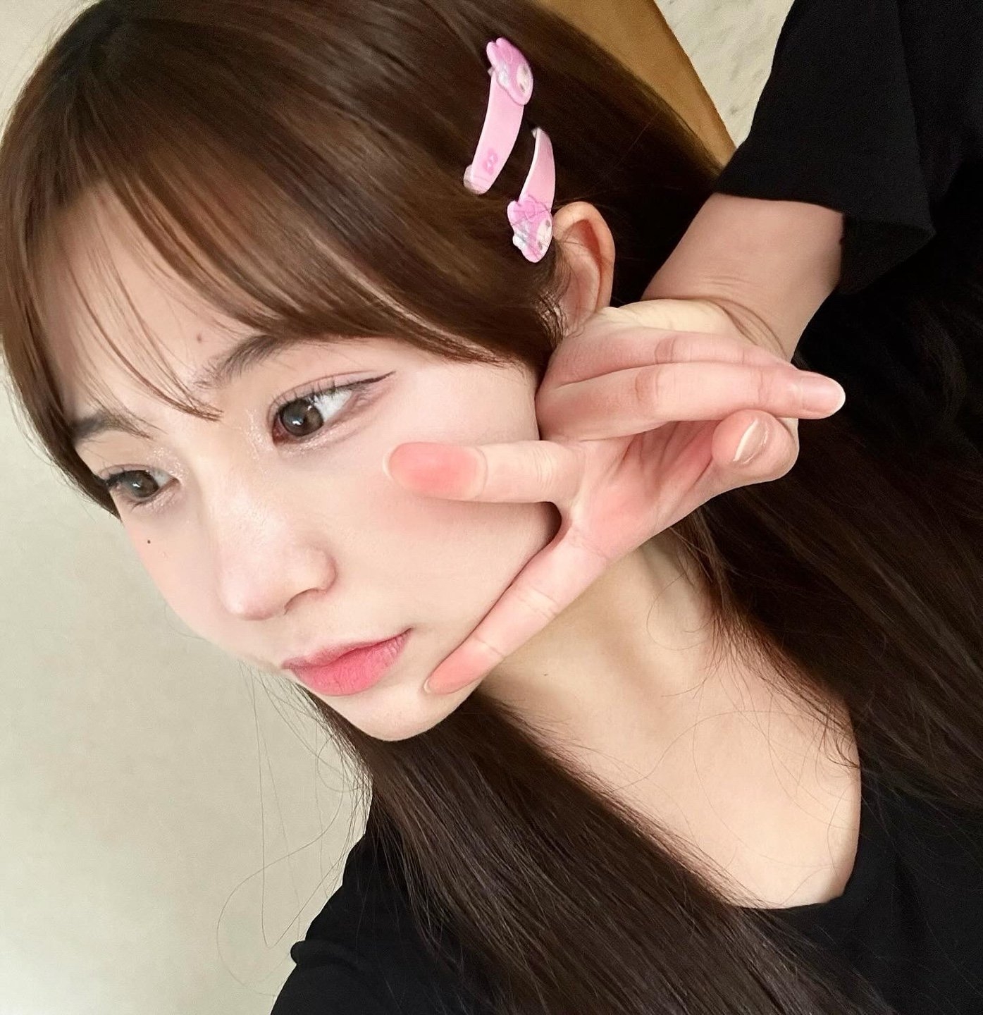 수술후기이미지