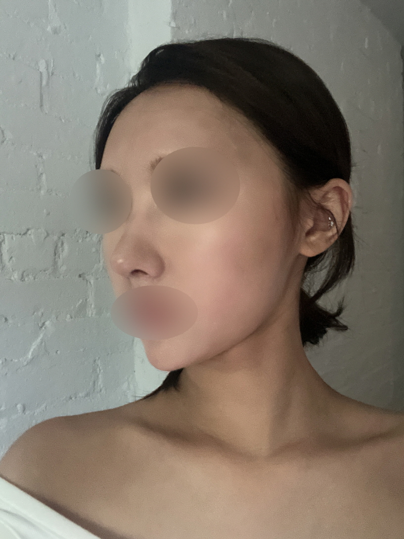 수술후기이미지