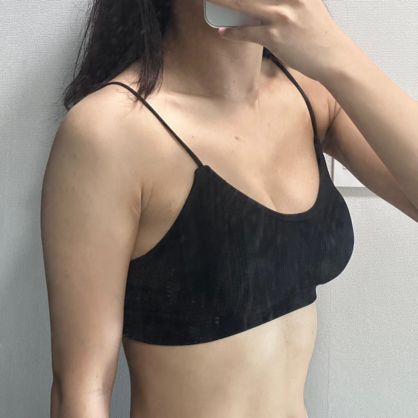 수술후기이미지