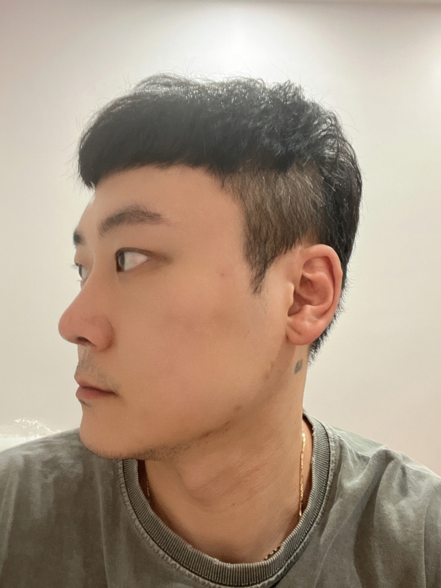 수술후기이미지