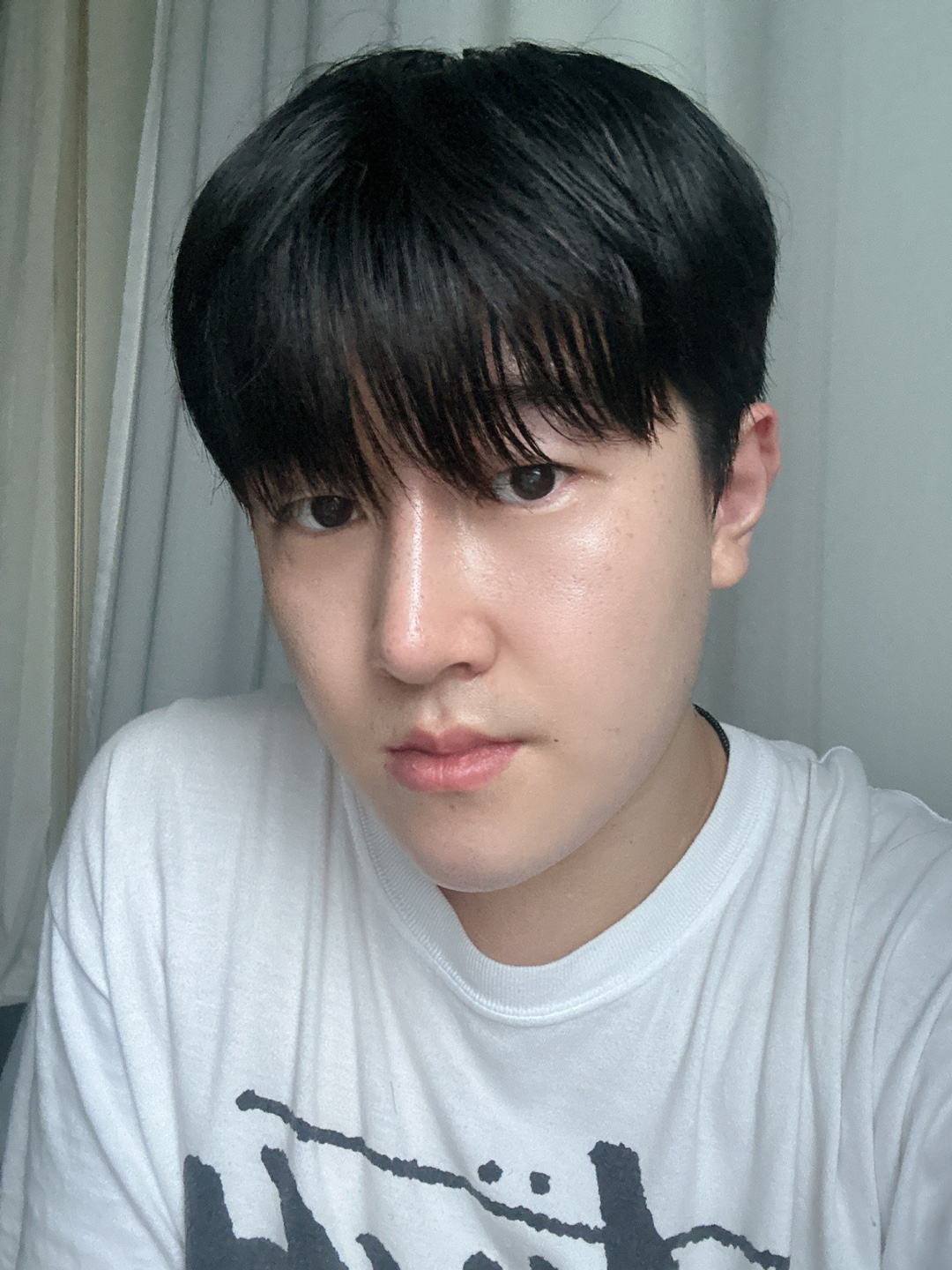 수술후기이미지