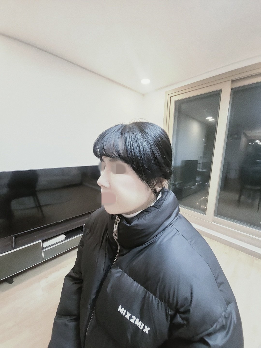 수술후기이미지