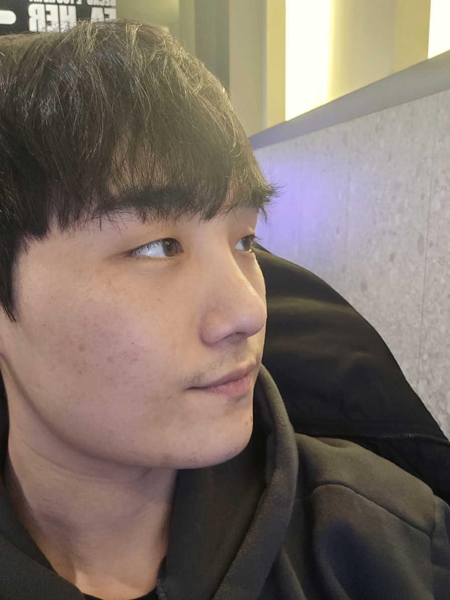 수술후기이미지