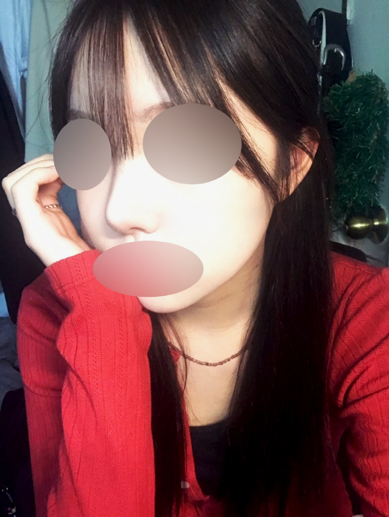 수술후기이미지