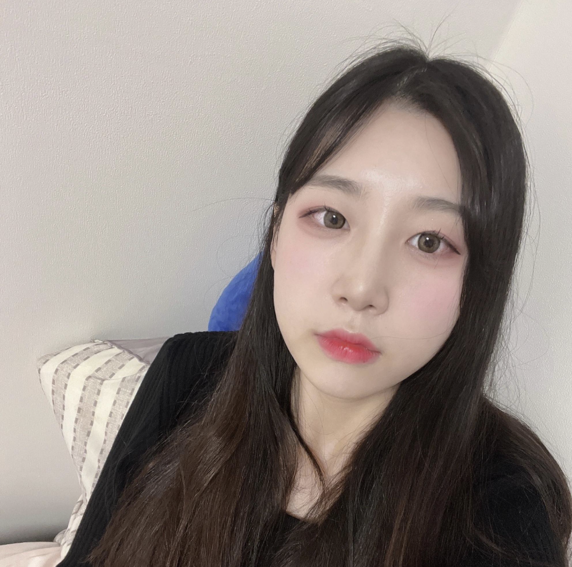 수술후기이미지