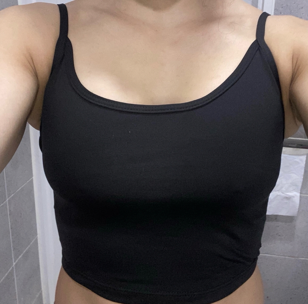 수술후기이미지