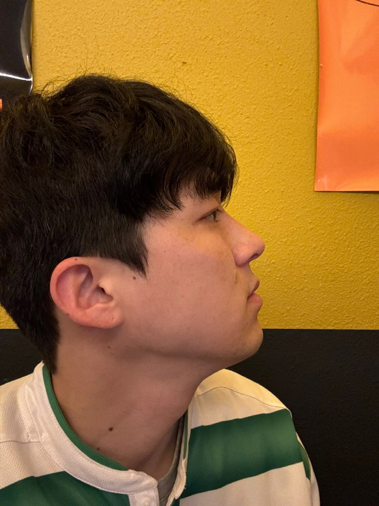 수술후기이미지