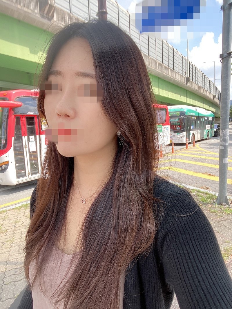 수술후기이미지