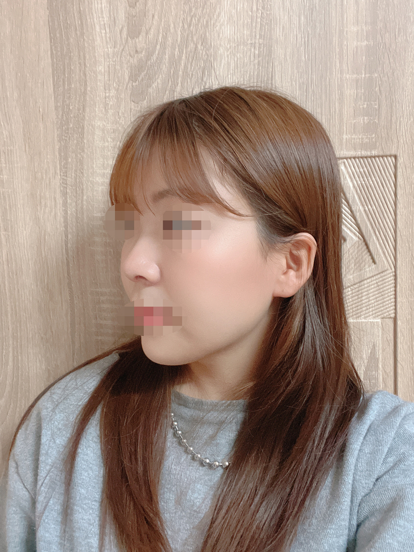 수술후기이미지