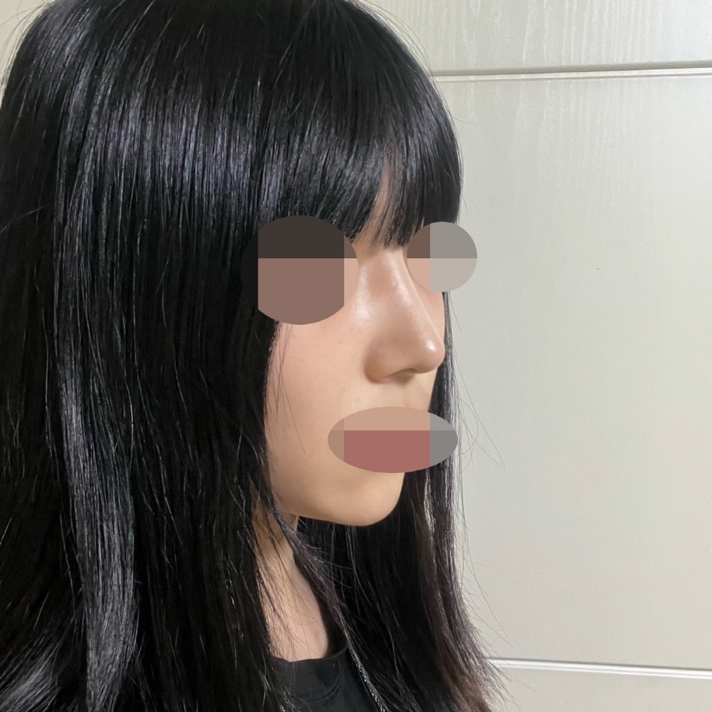 수술후기이미지