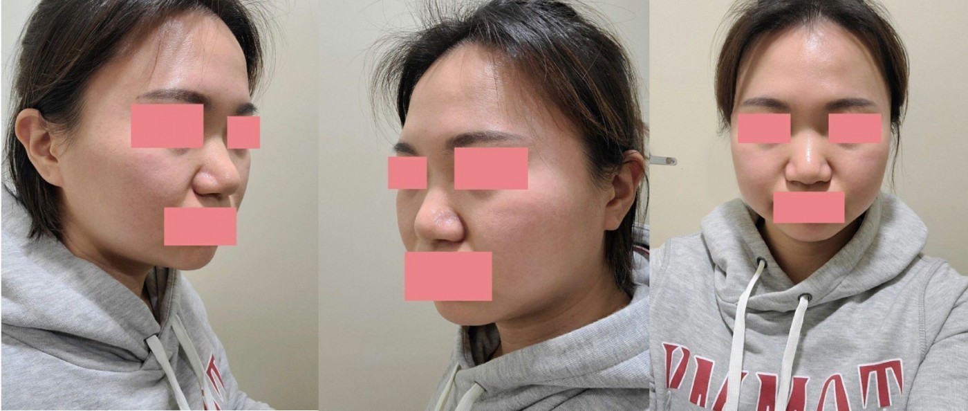 수술후기이미지