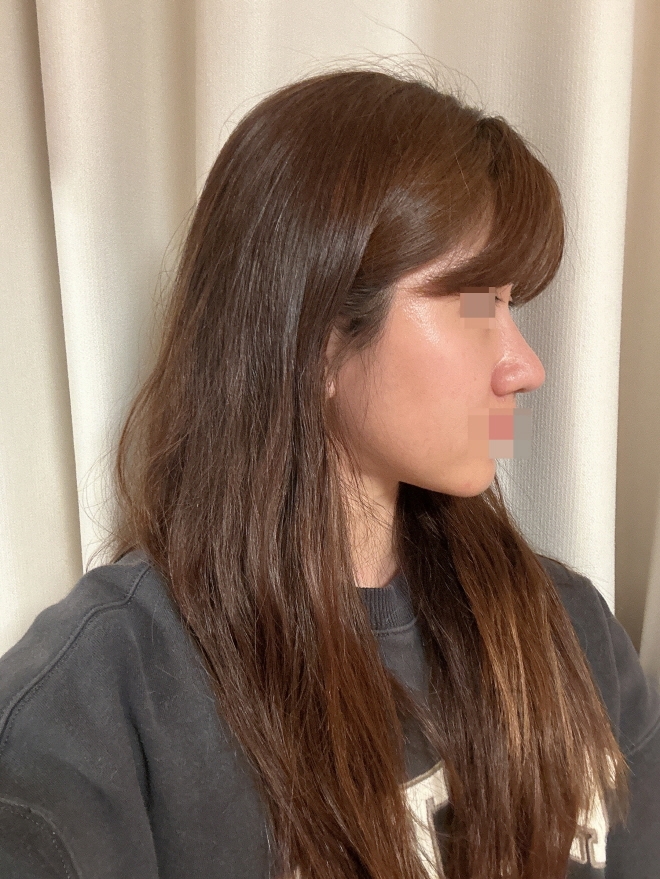 수술후기이미지