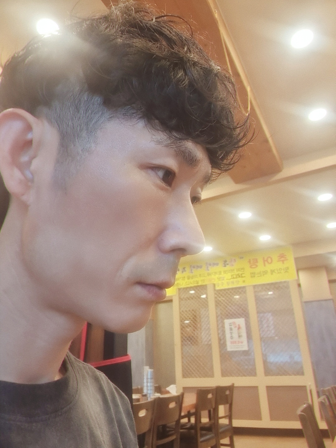 수술후기이미지