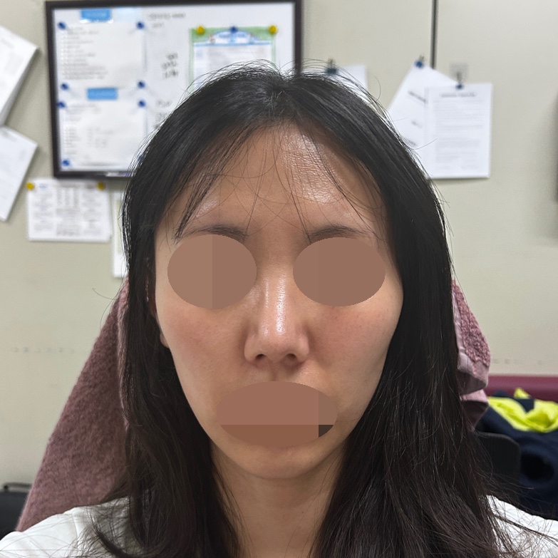 수술후기이미지