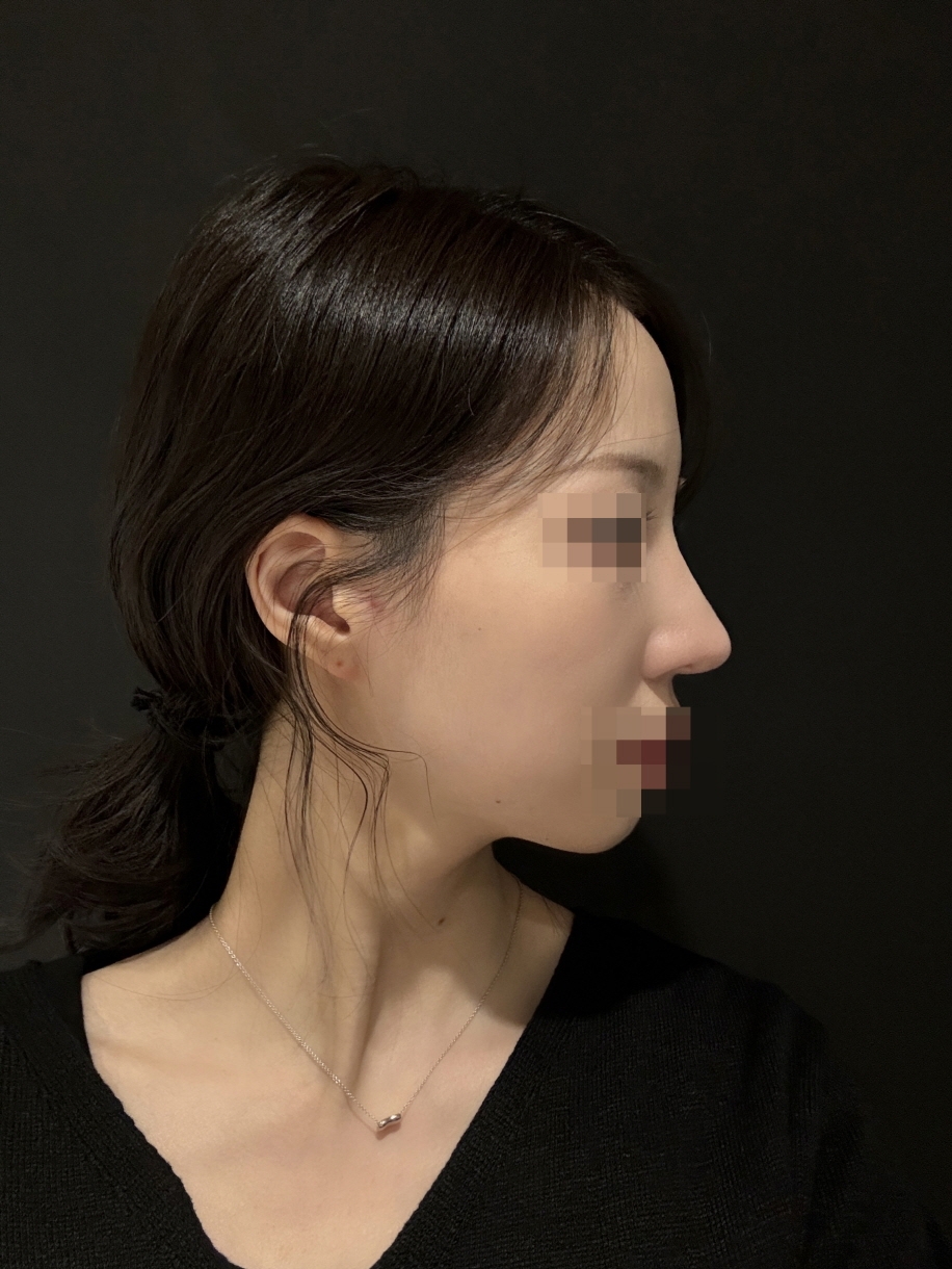 수술후기이미지