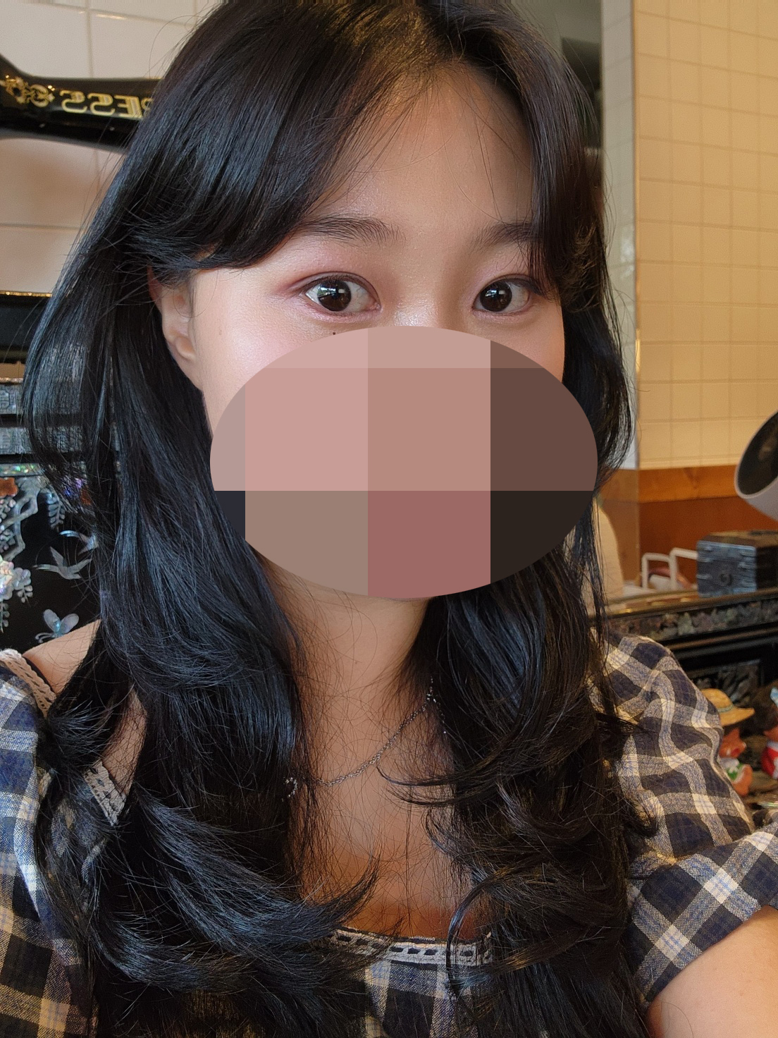 수술후기이미지