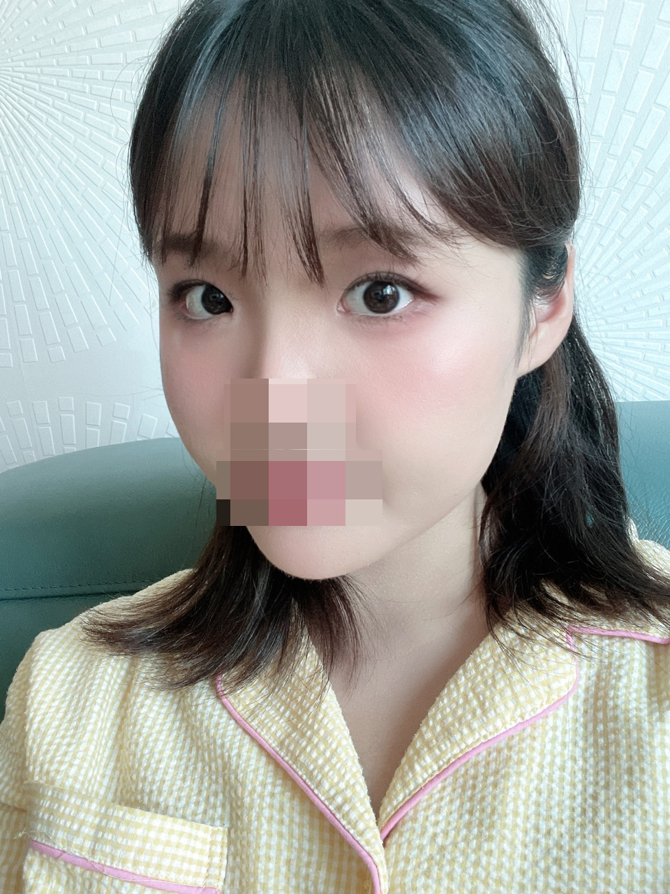 수술후기이미지