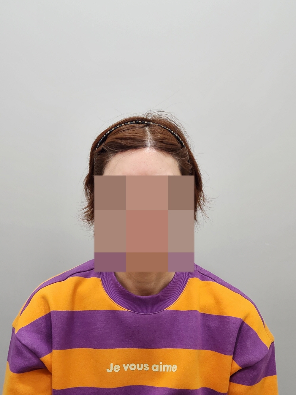 수술후기이미지