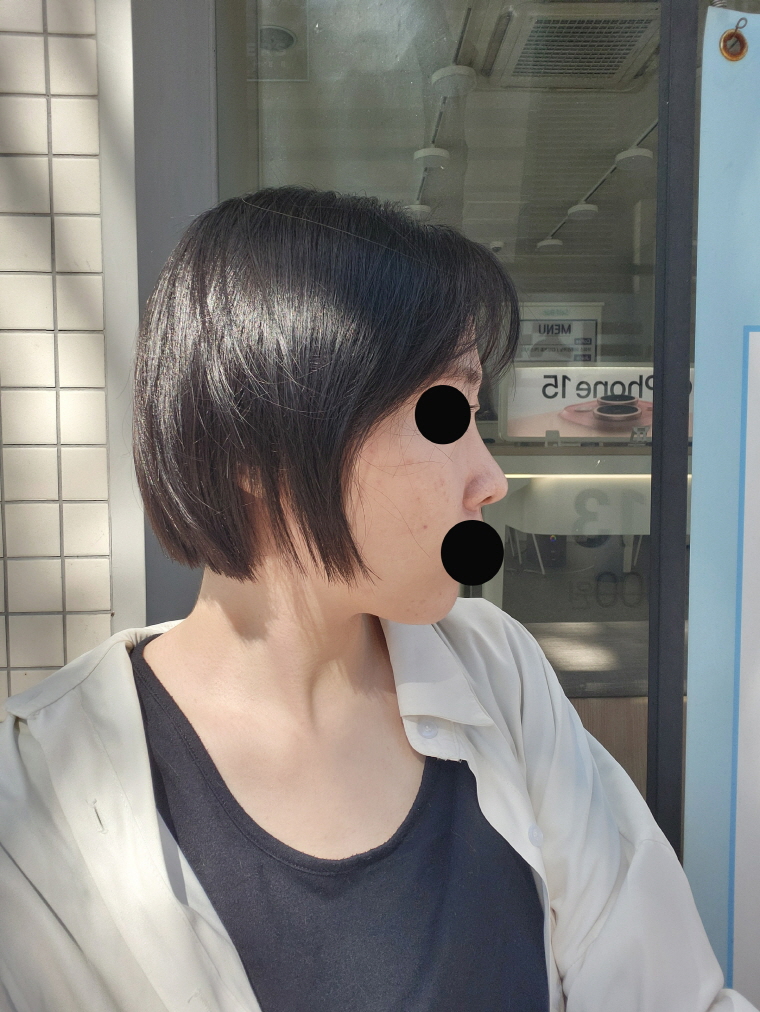 수술후기이미지