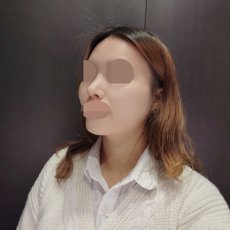 수술후기이미지