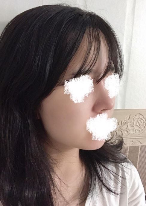 수술후기이미지