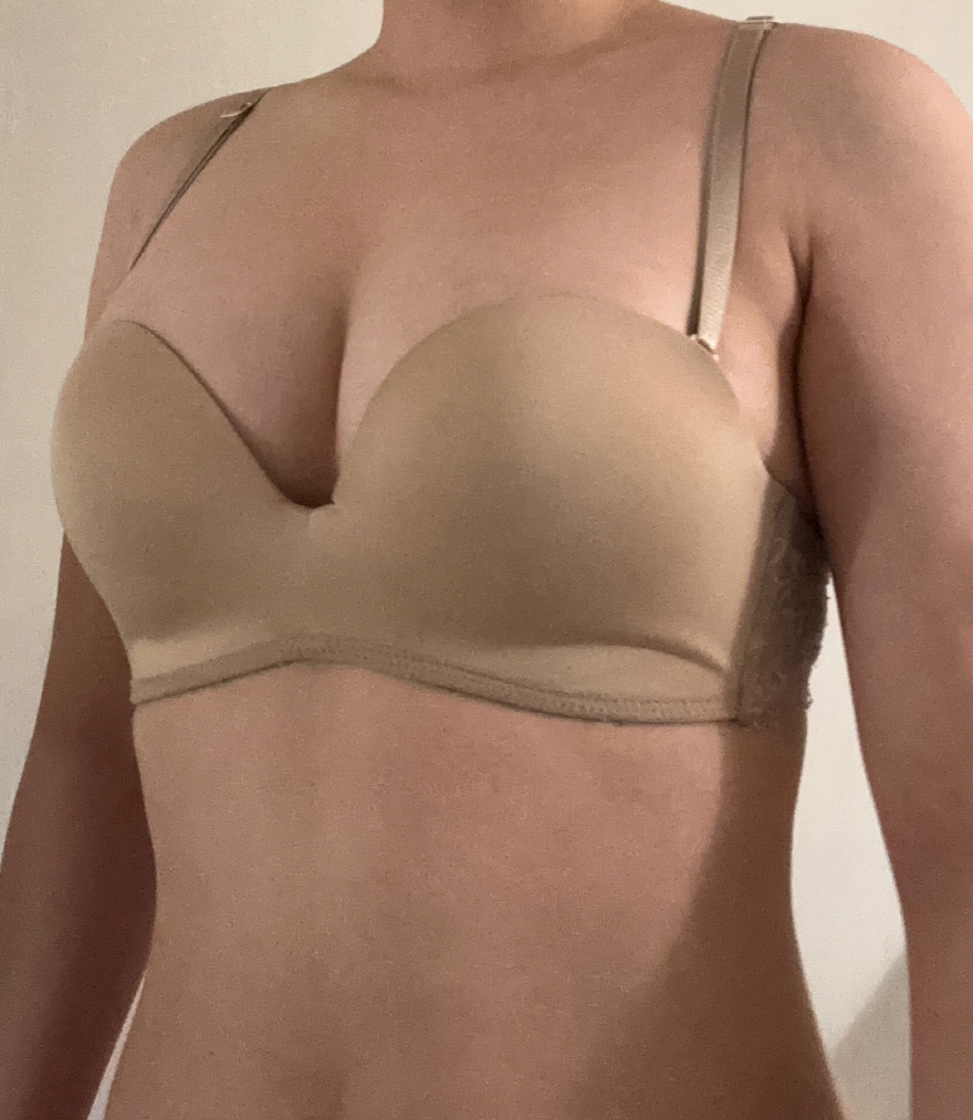 수술후기이미지