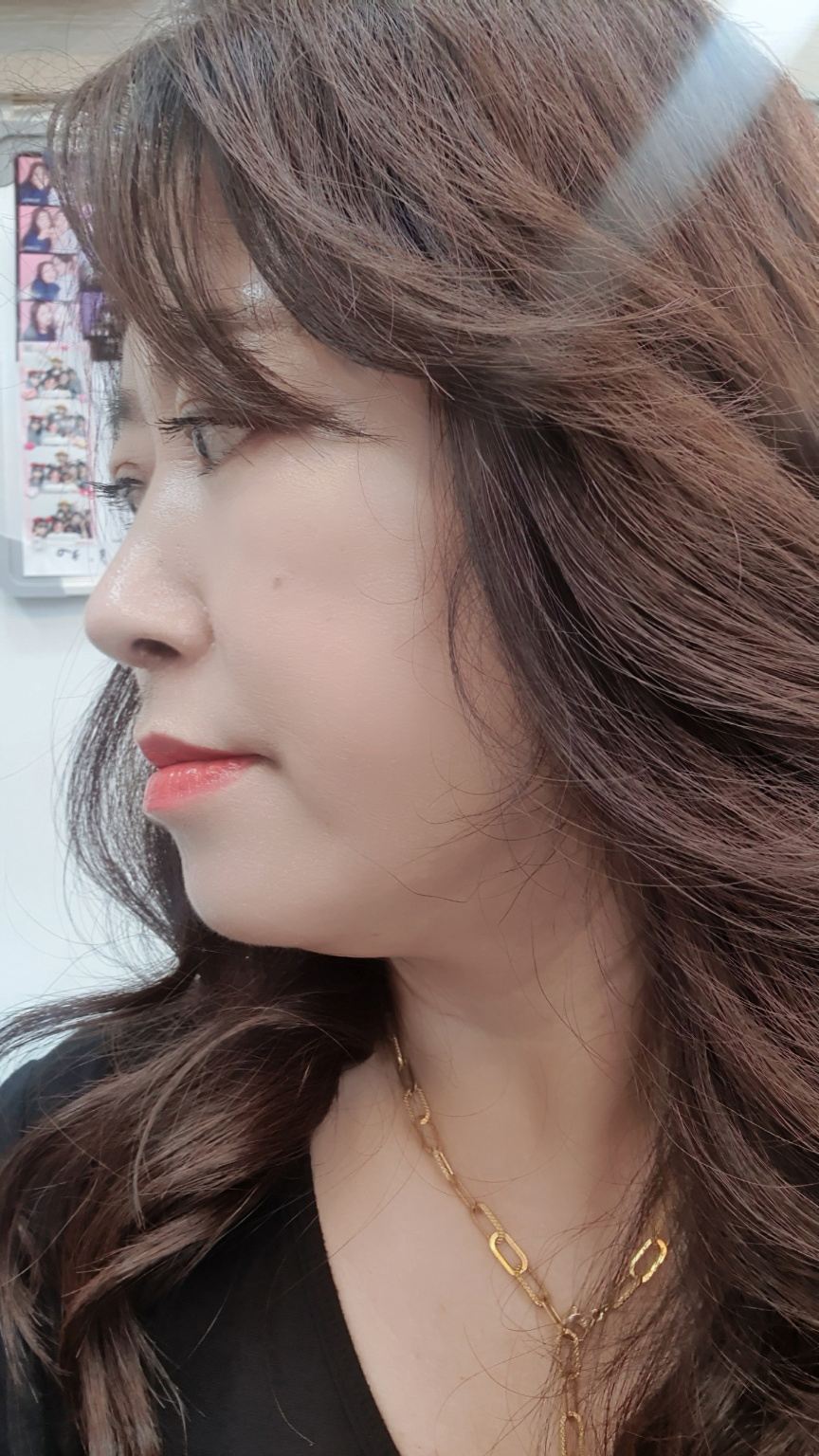 수술후기이미지