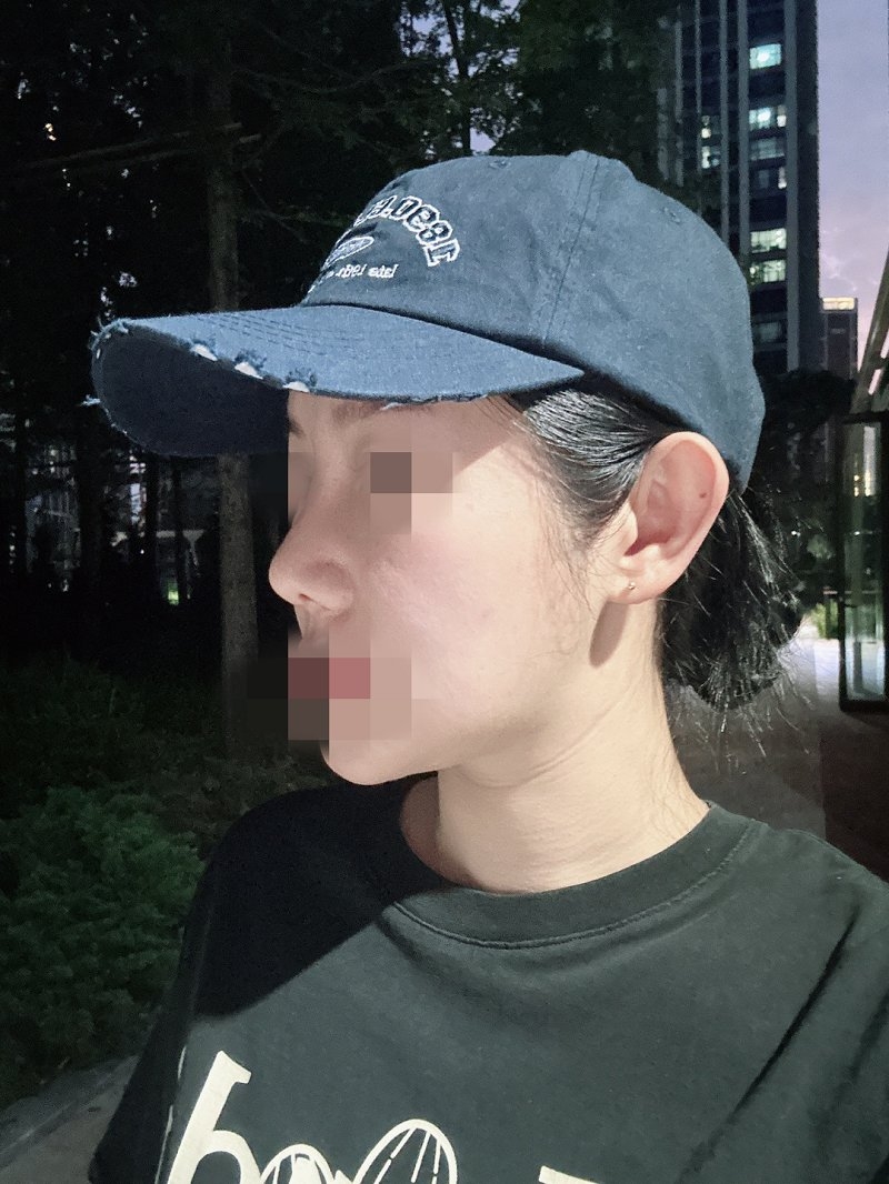 수술후기이미지