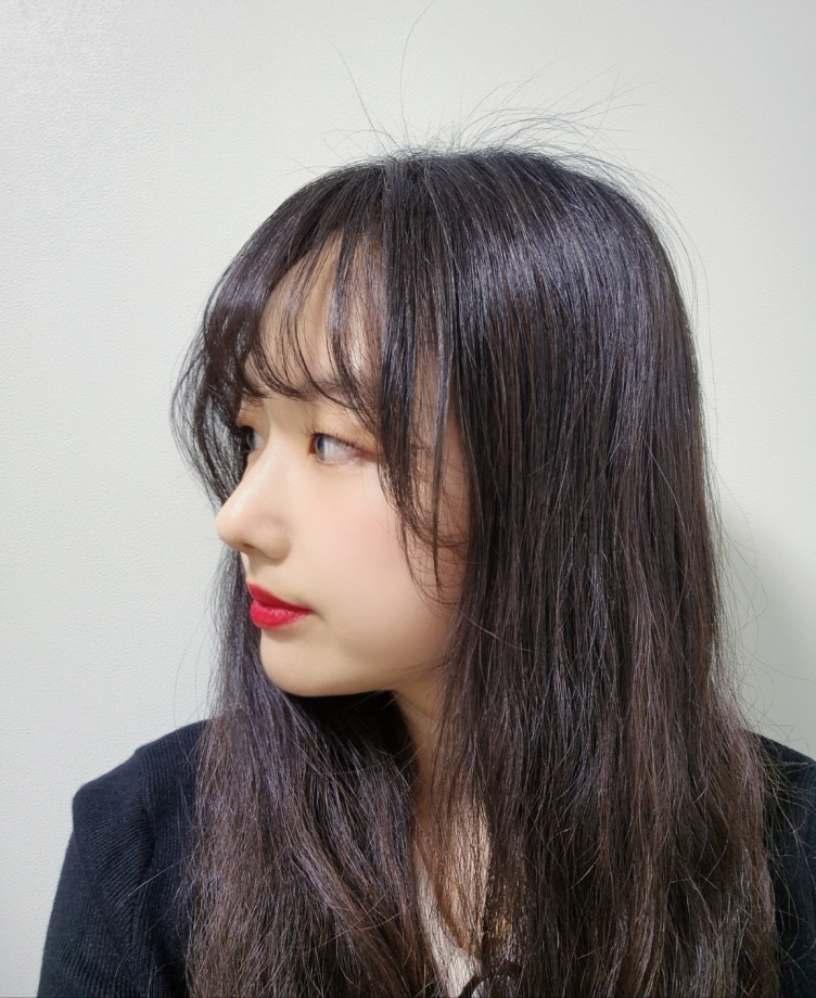 수술후기이미지