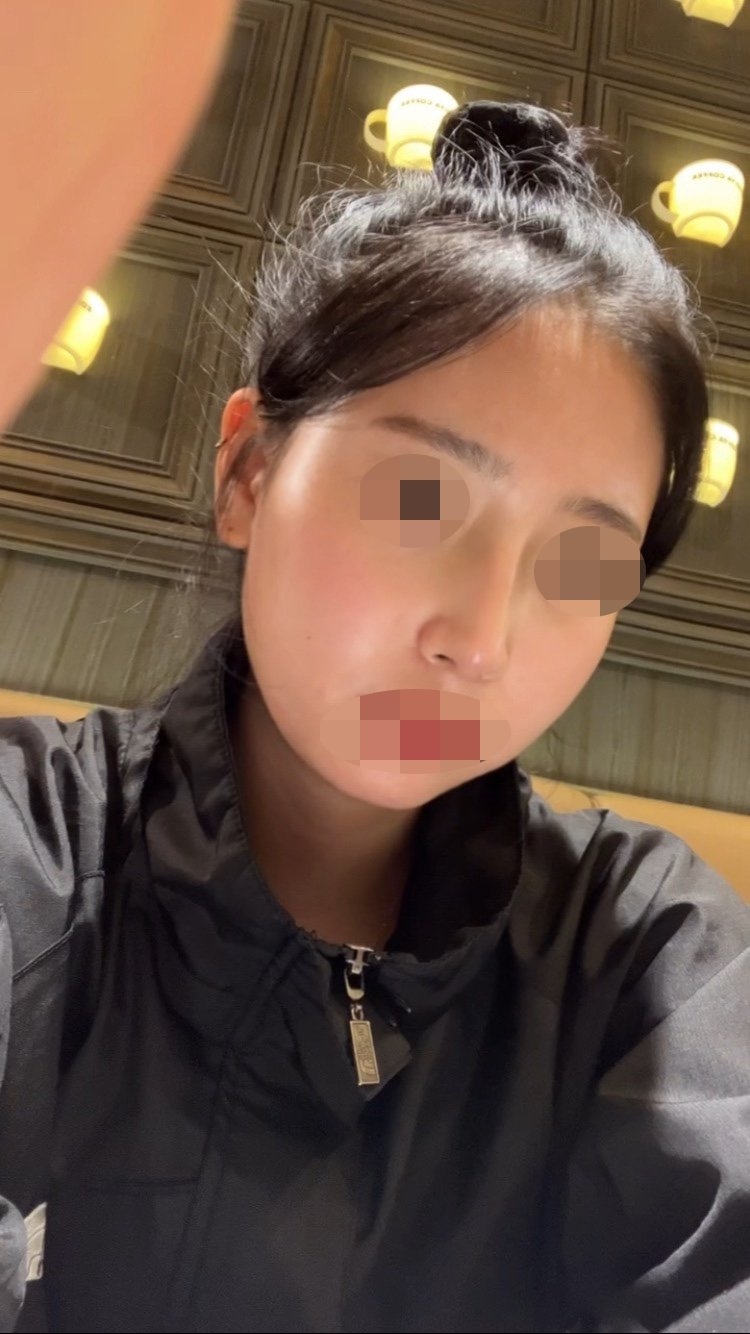 수술후기이미지